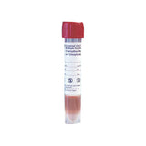 BD Universal Viral Transport 50 Count by BD